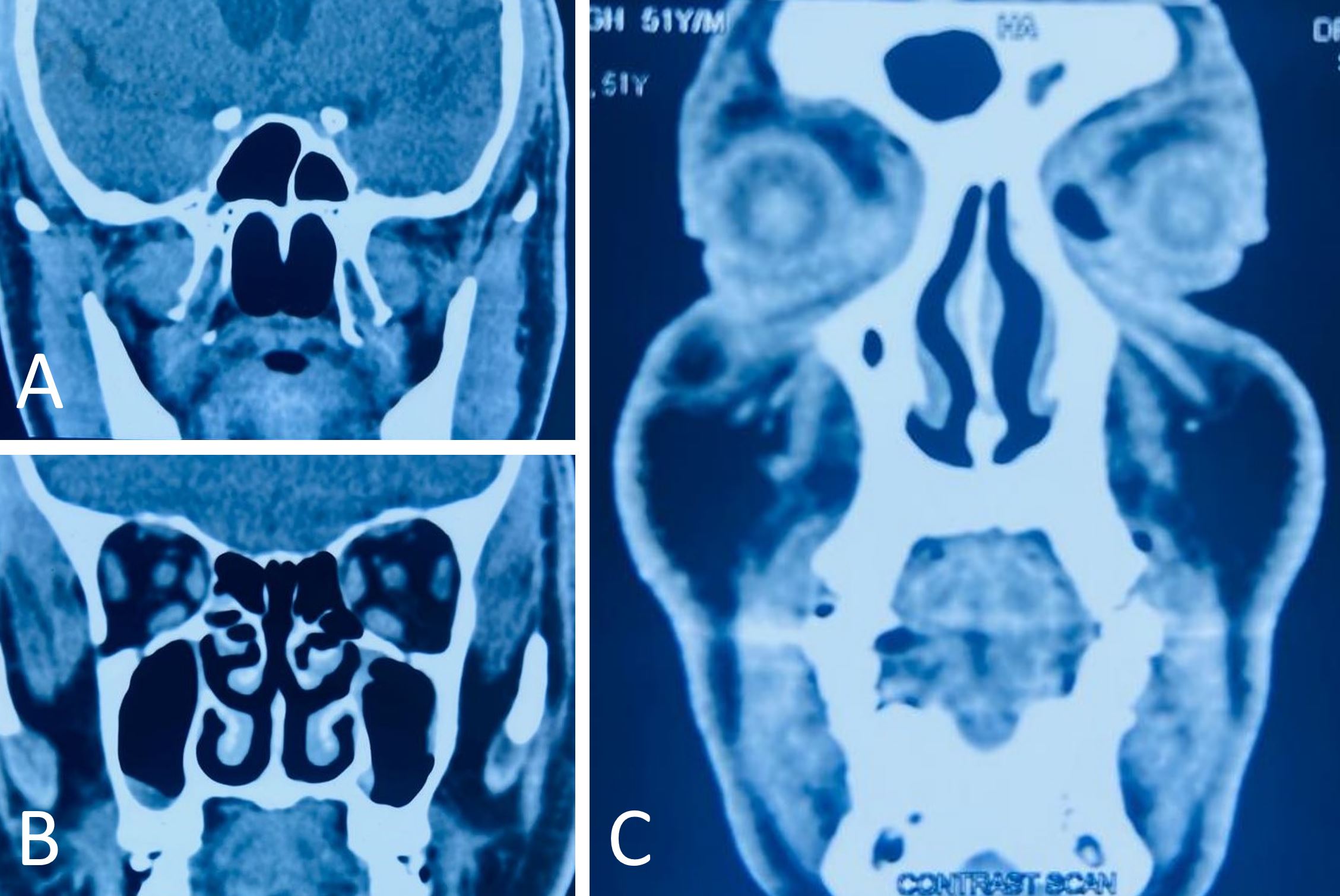 Figure 4.JPG